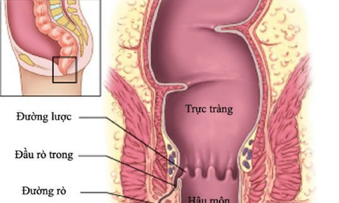 Quan hệ tình dục qua đường hậu môn: Con đường lây nhiễm HIV nguy hiểm nhất, làm sao để bảo vệ bản thân?