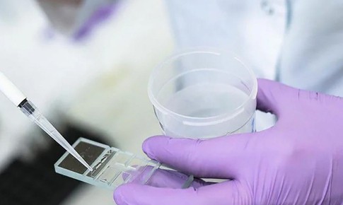 3 chiến lược bảo tồn khả năng sinh sản cho người nhiễm HIV