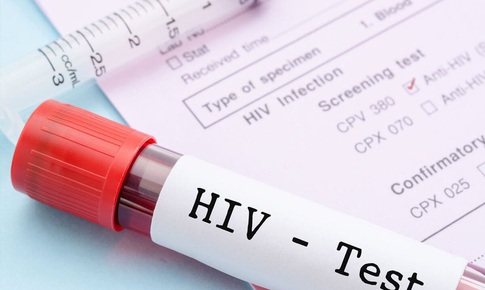 Làm thế nào để biết bạn có bị nhiễm HIV hay không?
