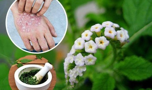 Sử dụng cây vòi voi chữa bệnh thế nào cho đúng?