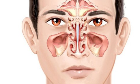 Bệnh viêm đa xoang có nguy hiểm không?
