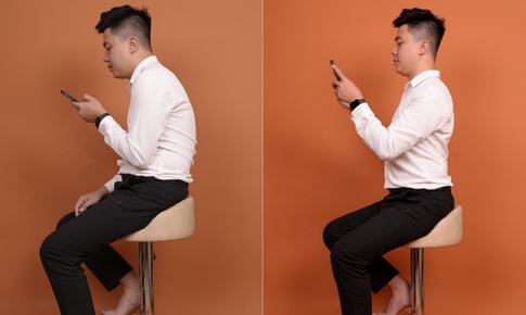 C&#250;i đầu l&#226;u xem điện thoại, ngồi học sai tư thế cũng c&#243; thể ảnh hưởng đến sai khớp cắn
