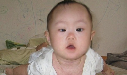 Trẻ mệt bất thường c&#243; thể mắc rối loạn nhược cơ bẩm sinh