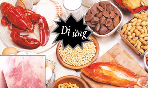 Bệnh Celiac nguy hiểm như thế nào?