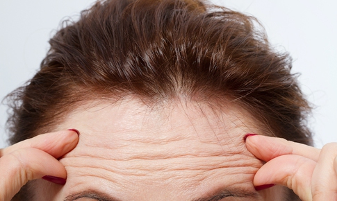 Thực phẩm bổ sung nào giúp chống lại nếp nhăn?