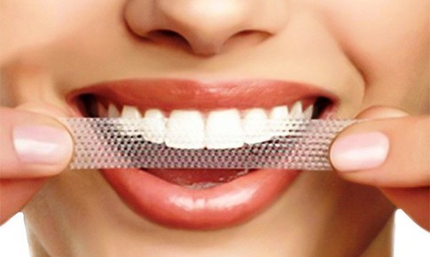Rủi ro khi lạm dụng miếng d&#225;n trắng răng