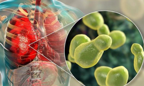 Những bệnh lý tại phổi nào thường gặp ở người nhiễm HIV?
