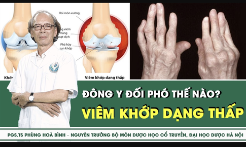 [LIVE] Vi&#234;m khớp dạng thấp: Đ&#244;ng y đối ph&#243; thế n&#224;o? 
