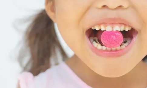 7 loại thực phẩm làm tăng nguy cơ sâu răng bạn nên biết để tránh