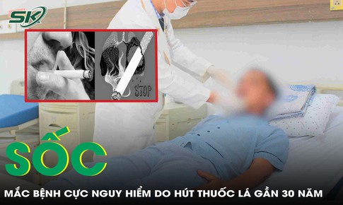 H&#250;t thuốc l&#225; gần 3 thập kỷ, người đ&#224;n &#244;ng sốc khi ph&#225;t hiện mắc bệnh cực nguy hiểm