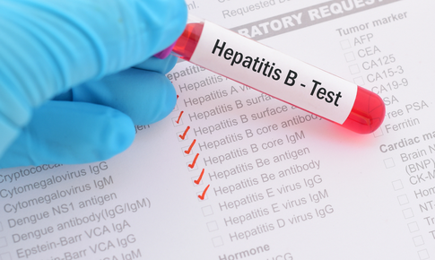Điều trị đồng nhiễm HIV: Bảo vệ sức khỏe và nâng cao chất lượng cuộc sống
