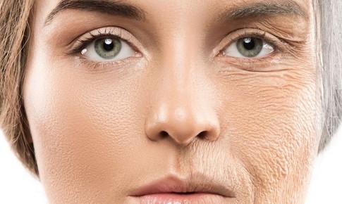 Kem chống nắng - tấm l&#225; chắn chống l&#227;o h&#243;a m&#249;a hanh kh&#244;