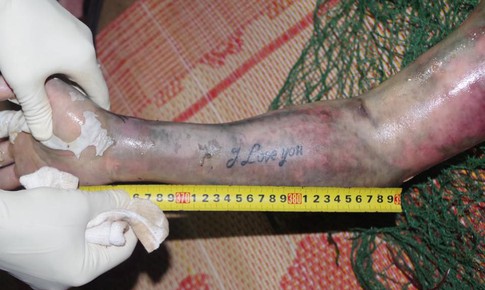 Truy t&#236;m tung t&#237;ch nạn nh&#226;n nổi tr&#234;n s&#244;ng, tr&#234;n tay xăm chữ &#39;I love you&#39;