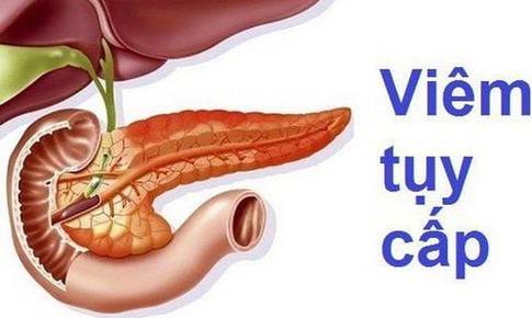 Bệnh vi&#234;m tụy c&#243; biểu hiện g&#236;, n&#234;n hạn chế ăn g&#236;?