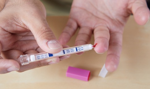 X&#233;t nghiệm HIV sớm, bước mở đầu quan trọng trong ph&#242;ng, chống HIV/AIDS