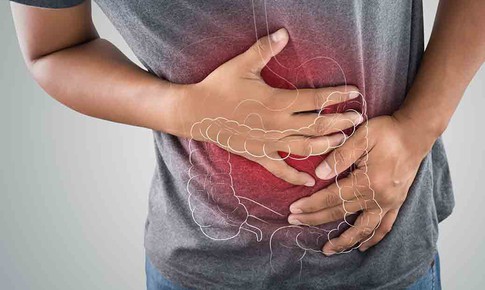 Dấu hiệu thường gặp của vi&#234;m lo&#233;t đại trực tr&#224;ng 