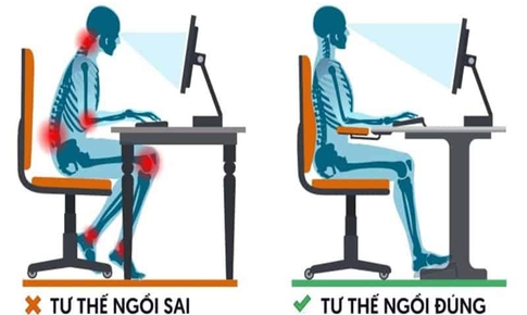 Th&#243;i quen ngồi g&#249; lưng, gối cao đầu ảnh hưởng đến ngoại h&#236;nh v&#224; sức khỏe thế n&#224;o?