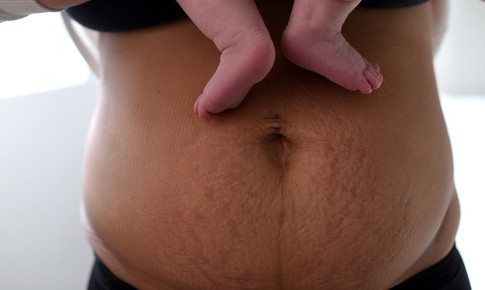 C&#225;c cột mốc hồi phục sức khỏe b&#224; mẹ trong 40 ng&#224;y sau sinh