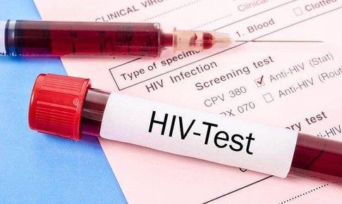 Thực trạng HIV/AIDS ở Việt Nam: Dịch đ&#227; được kiểm so&#225;t nhưng chưa thể chủ quan