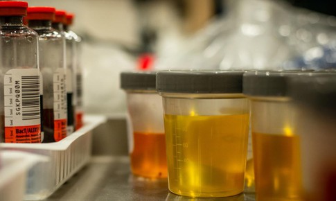 Tiểu ra m&#225;u c&#243; nguy hiểm kh&#244;ng?