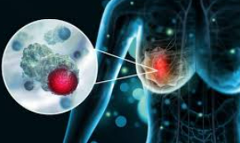 Nghiên cứu vaccine mới mở ra hy vọng chống lại ung thư vú thể nguy hiểm nhất