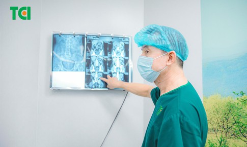 Sỏi 'ẩn nấp' ngách bể thận: Loại bỏ nhẹ nhàng bằng tán sỏi hiện đại