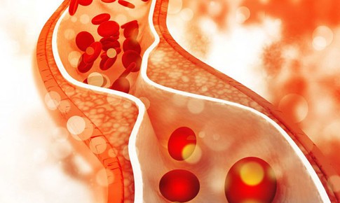 Tăng triglycerid máu: Hiểm họa tiềm ẩn và cách kiểm soát hiệu quả