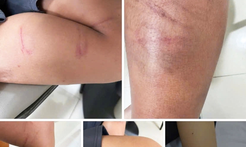 Xác minh clip người đàn ông hành hung 3 bé trai giữa đường