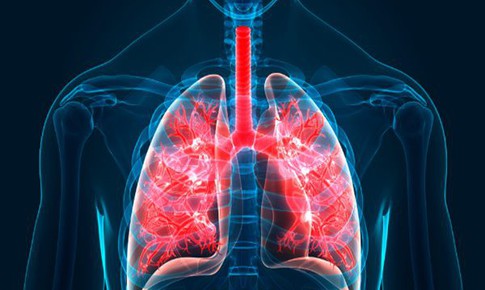 5 triệu chứng thường gặp của bệnh xơ phổi