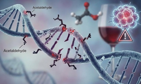 Rượu bia và ung thư vú: sự thật ít ai biết khiến phụ nữ trẻ lo ngại