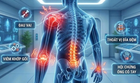 Bí kíp để hệ vận động khỏe mạnh: lời khuyên từ chuyên gia