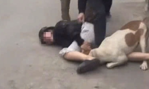 Thả chó dữ tấn công người khác có thể bị xử lý hình sự