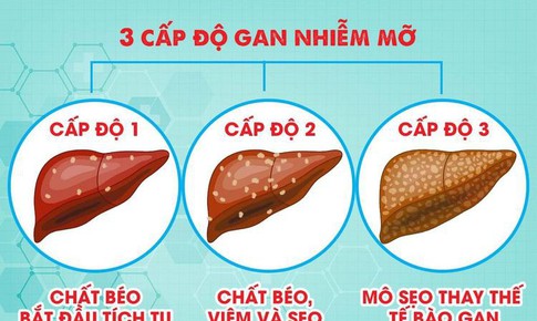 Hai cách đơn giản giúp bảo vệ gan khỏe mạnh mỗi ngày