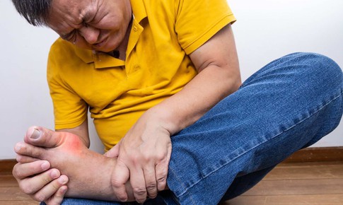 Cảnh giác với 2 loại đồ uống có thể làm bùng phát cơn gout cấp trong kỳ nghỉ lễ