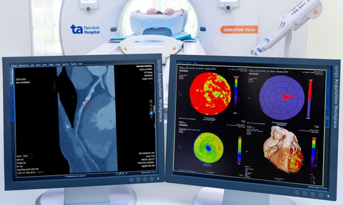 Si&#234;u m&#225;y chụp CT hỗ trợ c&#225;c b&#225;c sĩ ph&#225;t hiện sớm ung thư, đột quỵ