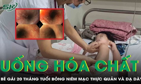 Uống nhầm h&#243;a chất, b&#233; g&#225;i 20 th&#225;ng tuổi suy h&#244; hấp, hoại tử ni&#234;m mạc