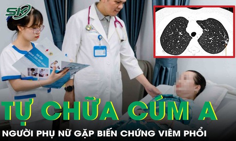 Tự mua thuốc trị c&#250;m A, người phụ nữ gặp biến chứng vi&#234;m phổi nặng