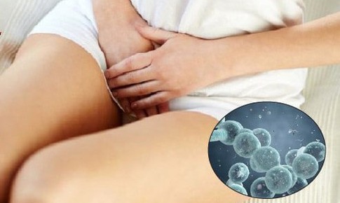 Nhiễm nấm Candida c&#243; g&#226;y v&#244; sinh kh&#244;ng?