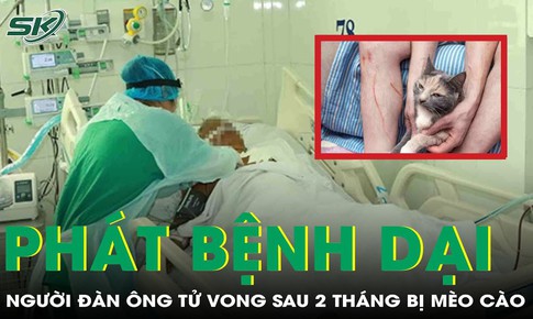 Người đàn ông tử vong nghi do bệnh dại sau 2 tháng bị mèo hoang cào vào bắp chân