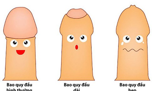 Câu hỏi thường gặp liên quan đến bệnh hẹp bao quy đầu