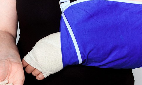Câu hỏi thường gặp liên quan đến hội chứng Sudeck