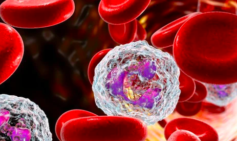 Câu hỏi thường gặp liên quan đến bệnh leukemia kinh dòng bạch cầu hạt