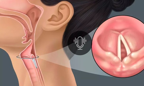 Câu hỏi thường gặp liên quan đến bệnh lao thanh quản