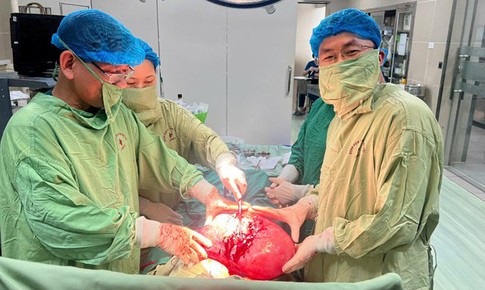Người phụ nữ bất ngờ phát hiện khối u xơ tử cung chiếm gần trọn ổ bụng sau một năm mãn kinh
