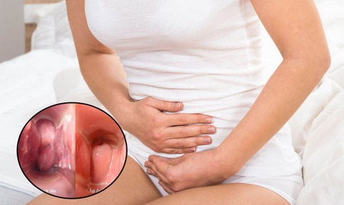 Viêm âm đạo và mối nguy hiểm với khả năng sinh sản