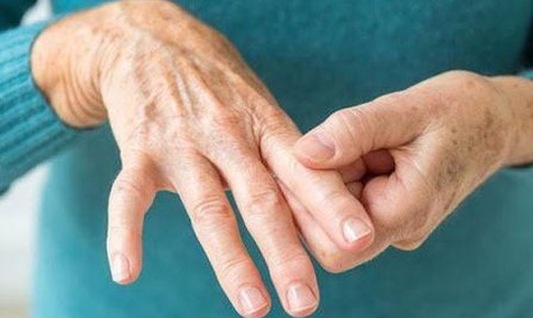 Người bệnh viêm khớp dạng thấp có nên tập thể dục?