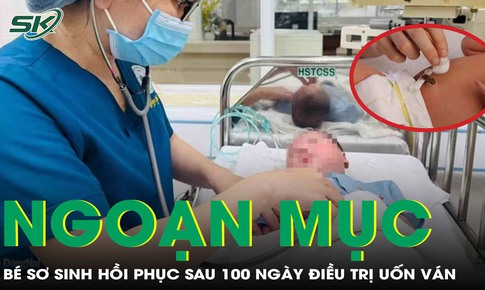 Bé trai sinh non bị uốn ván rốn hồi phục ngoạn mục sau gần 100 ngày điều trị tích cực