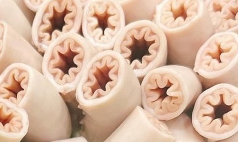 Chuyên gia: Con lợn nào có nhiều giun sán thì khả năng có lòng se điếu