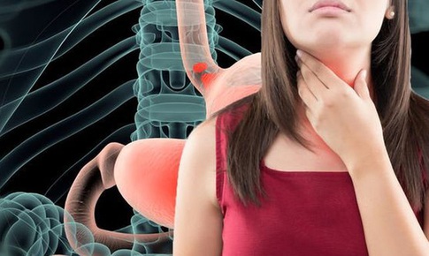 Học sinh lo lắng, căng thẳng ôn thi dễ bị ợ nóng, trào ngược