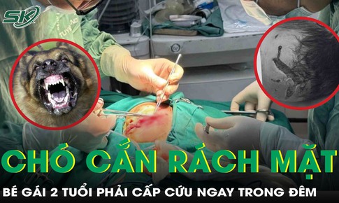 Cấp cứu ngay trong đêm cứu bé gái 2 tuổi bị chó nhà cắn rách mặt